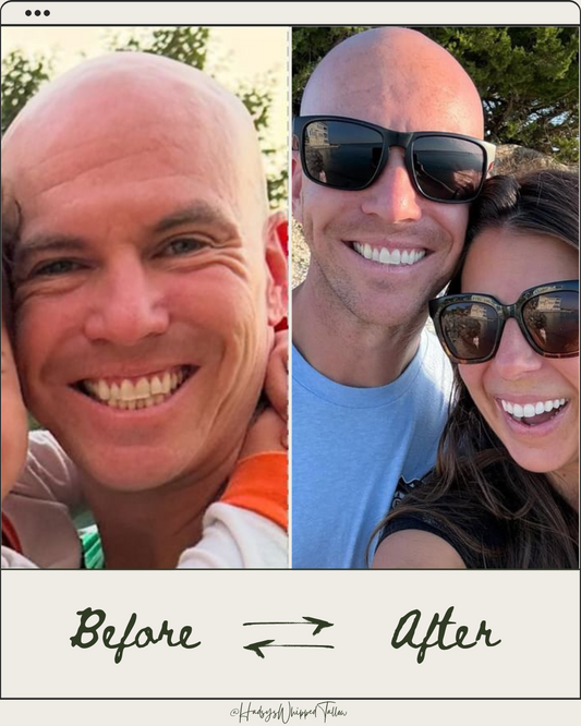 Before & After