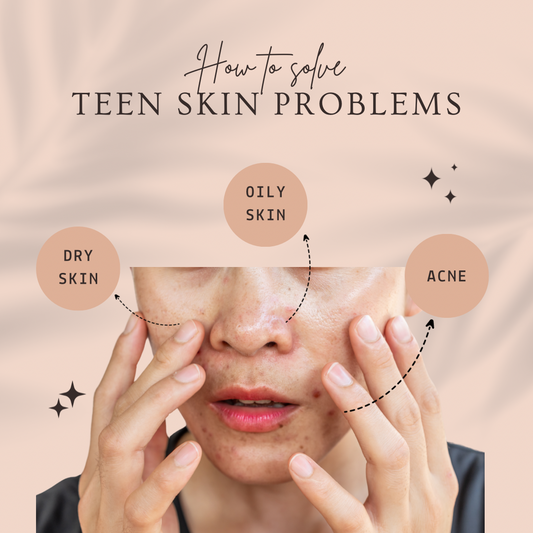 Combating Teen Skin Issues: Oily Skin, Dry Skin & Ance