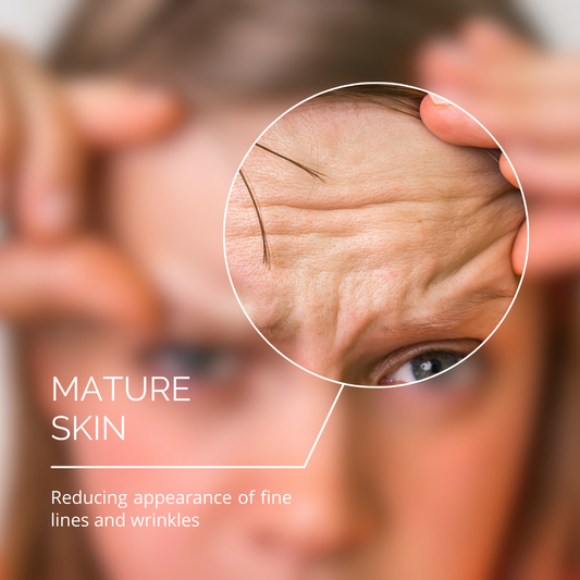 Mature Skin - Reducing the Appearance of Fine Lines and Wrinkles
